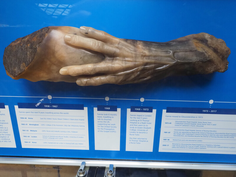 Display Cabinet for The Hand of Fannie Storr