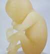 Foetus 2