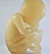 Foetus 3